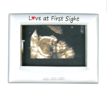 Ultra Sound Frame Personalized Christmas Ornament